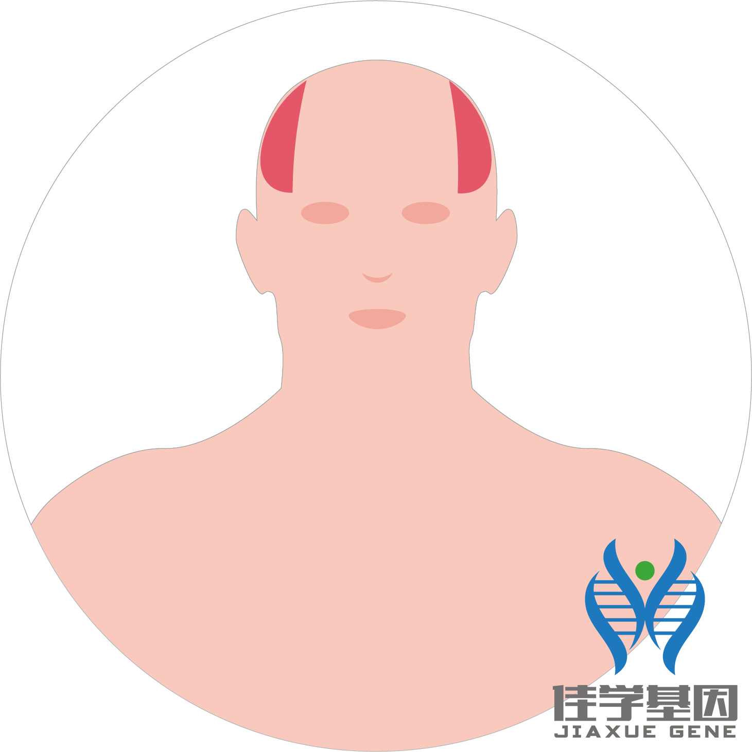 【佳學基因檢測】男性<font color='red'>脫發(fā)</font>（Androgenetic alopecia）基因解碼、<a href=http://www.jinzhounet.cn/tk/jiema/cexujishu/2021/31933.html>基因檢測</a>